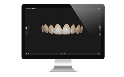 Exocad DentalCAD