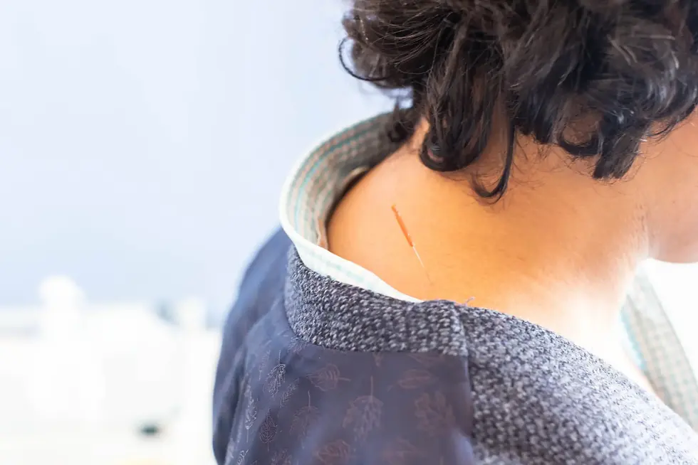 Acupuncture for Neck Pain - Empower Acupuncture, Morden