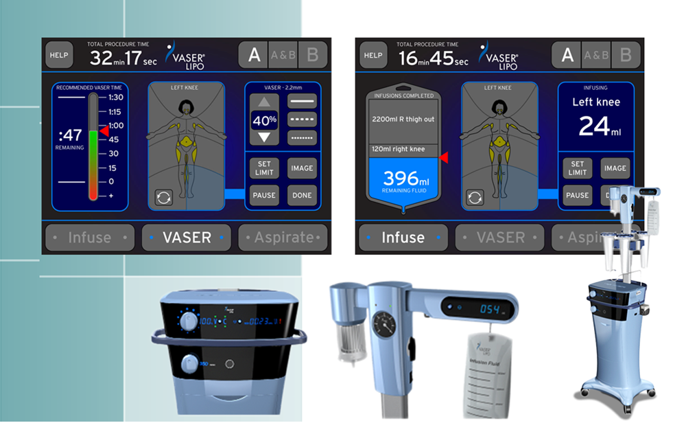 Software | User Interface