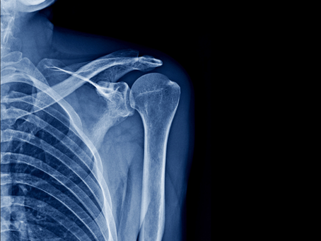 When to Image? A Physio’s View on Scans