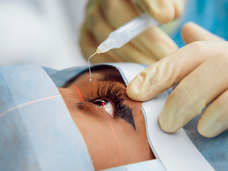 Common Vision Changes After Cataract Surgery and When to Be Concerned