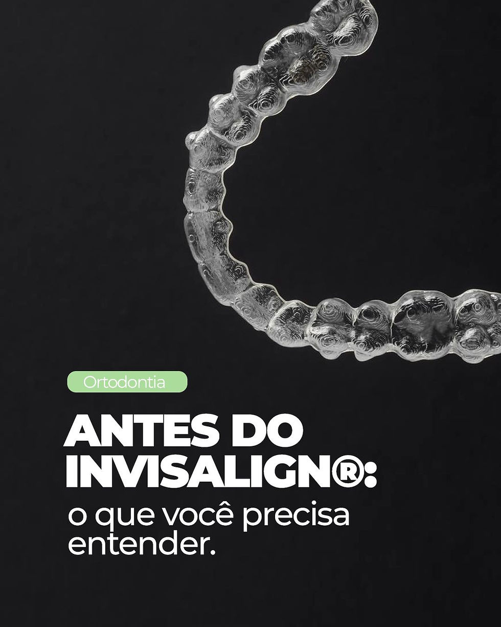 Antes do Invisalign®: o que você precisa entender e como o escaneamento intraoral com iTero Lumina transforma seu tratamento
