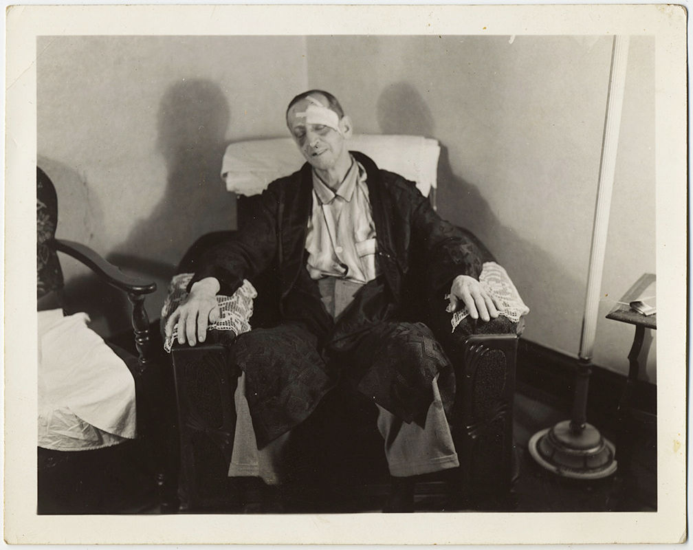 WOUNDED DAMAGED BANDAGED BATTERED MAN on EASY CHAIR in PAJAMAS CROCHETED COVERS