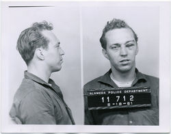 fp2212(Mugshot-Bruised-Eye)