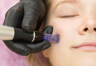 needle-mesotherapy-cosmetologist-performs-needle-mesotherapy-womans-face-beautiful-woman-r