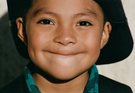 Junior with scar 65665-48-0013.jpg