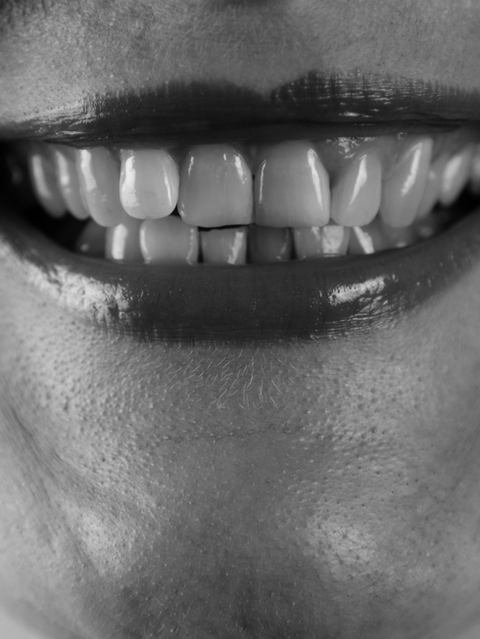 Root Canal Oli Hinton Dental