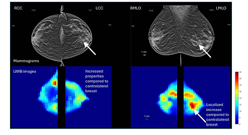 tumor patient images.jpg
