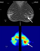 tumor patient images v2.jpg