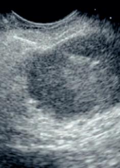 Captura de tela 2026-01-17 231238.png