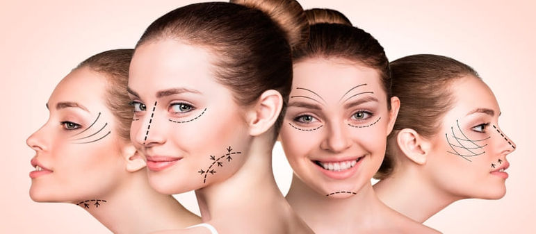 Implante facial