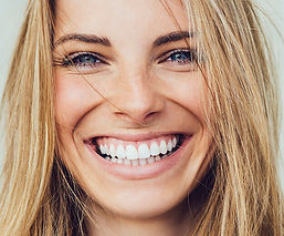 teeth-whiteningImage.jpg