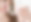 clearsmile-aligner-2.png