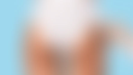 Harmonização de Glúteo Tridimensional: Uma Revolução na Estética Corporal