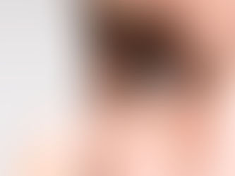 Quais os riscos de dormir com as lentes de contato?