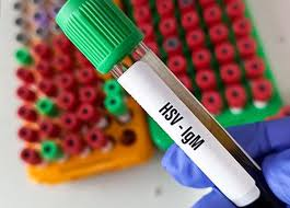 Seven Dead, 92 Inmates Infected with Herpes Virus at Overcrowded Jalpaiguri Correctional Home