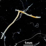 Microplastics: what they are and how you can reduce them.  Natural History Museum. 
