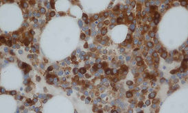 Lysozyme-(Muramidase) Polyclonal.jpg