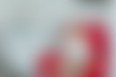 Kilo vermek için Bıçak Altına Yatmaya Gerek Yok