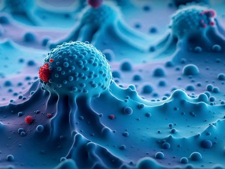 Prostat Kanserinde Erken Tanı Hayat Kurtarıyor