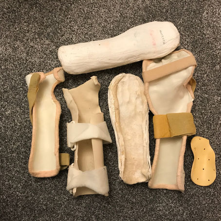 Wearing a splint as an adult with Erbs Palsy