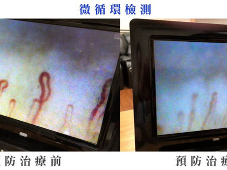 從末梢循環發掘疲勞的真相 | 預防中風