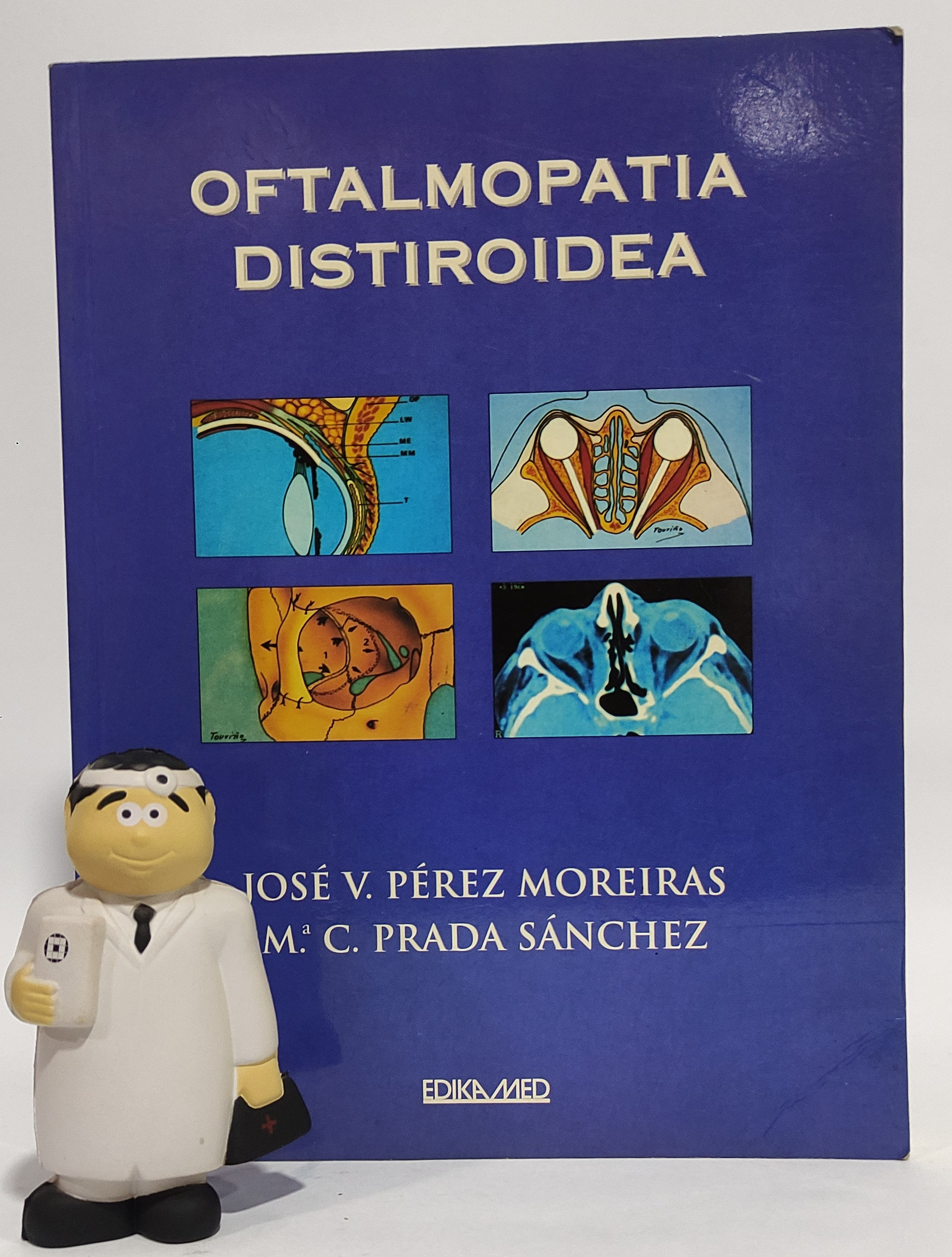 Oftalmopatía Distiroidea