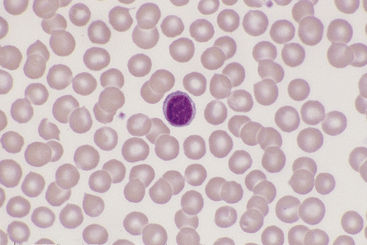 Diminution des lymphocytes