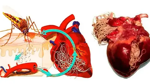 Vers du cœur (dirofilariose)