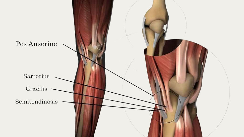 These tendons attach just below the medial knee joint on the tibia. A bursa lies beneath them to reduce friction. Overload, poor biomechanics, or inflammation of the bursa or tendons results in pes anserinus syndrome (Aicale et al., 2024).