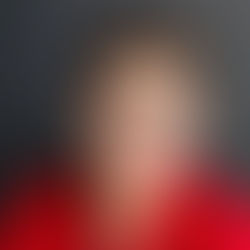 HIP UPDATE. Nash Roe's latest update from skiing accident that lead to a broken hip.