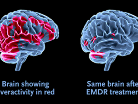 What is EMDR therapy?