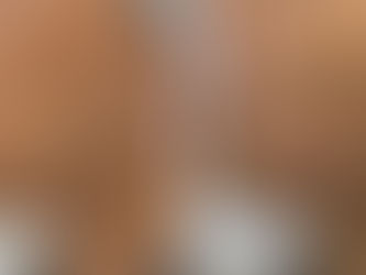 Understanding HIFU: Is This Non-Surgical Treatment Right for You in Birmingham?