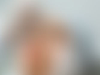 💉 Botox vs Dermal Fillers: What's the Difference?