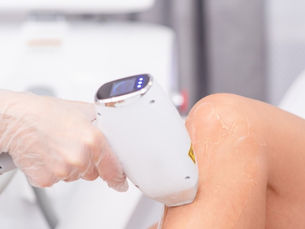Laser Hair Removal in Birmingham.