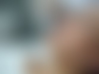 Transform Your Skin: Exploring Microneedling in Birmingham for Scarring Pigmentation and Anti-Aging