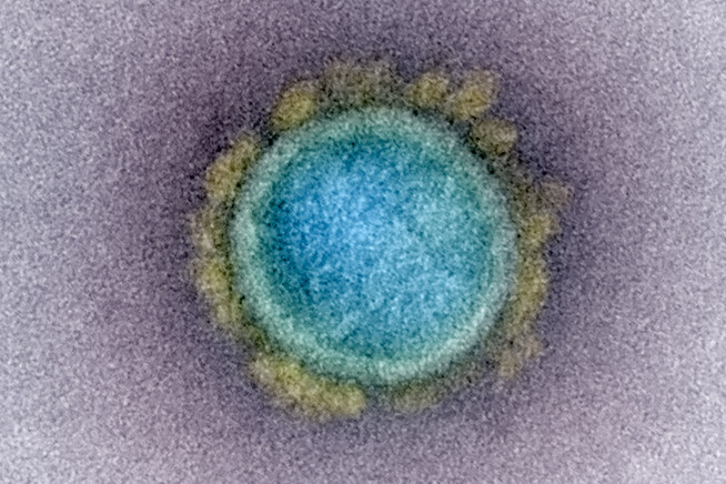 A close-up image of a virus particle artificially colored blue and yellow on a purple background.
