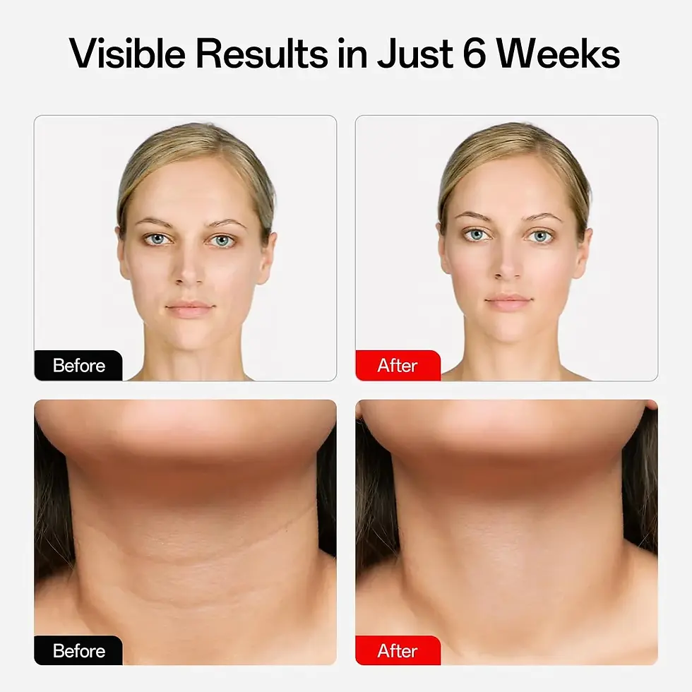 Arrugas y líneas finas: La RLT ayuda a reducir la apariencia de arrugas y líneas finas al aumentar la producción de colágeno