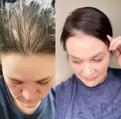 Thumbnail: Awaken Conditioner