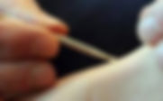 Pediatric treatment, Sho Ni Shin, Acupuncture clinic