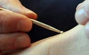 Pediatric treatment, Sho Ni Shin, Acupuncture clinic