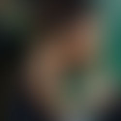 What Are The Key Benefits Of Exercise For Managing PCOS?