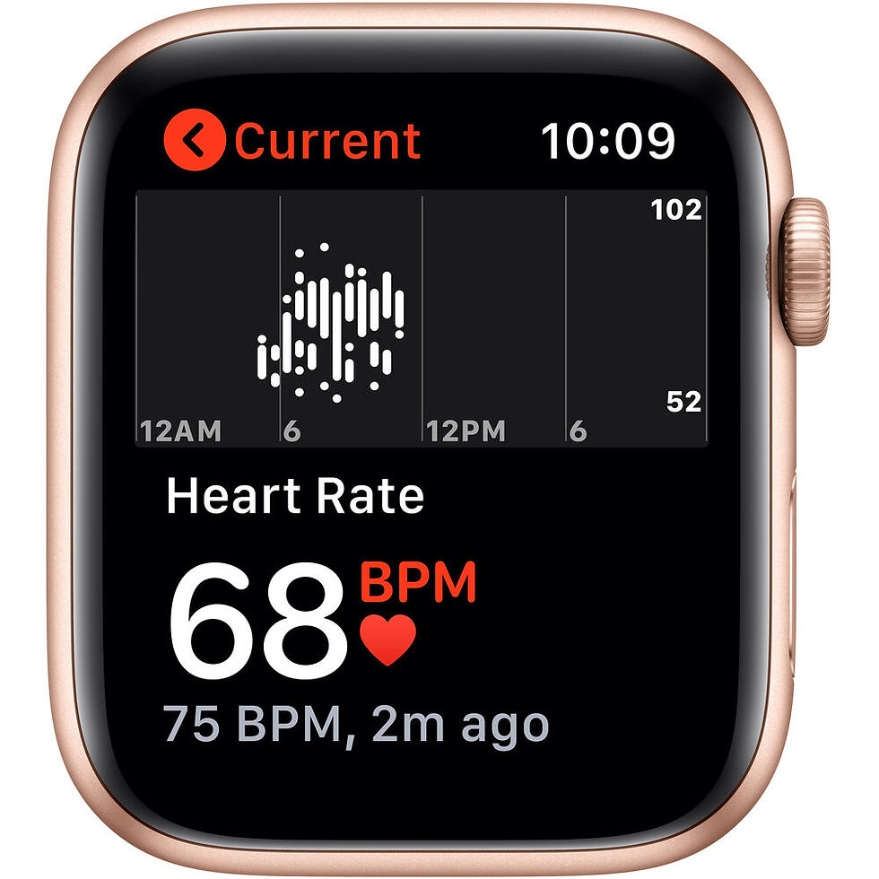 Thumbnail: Apple Watch SE (GPS + Cellular, Gold Aluminum, Pink Sand Sport Band)