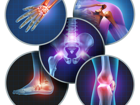 Noisy Joints? Here's What It Means...