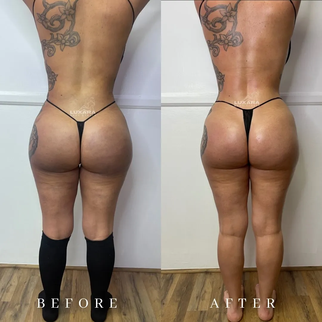 Luxara Body Studio