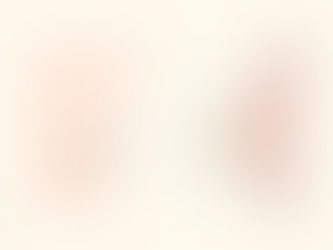 What is a radio frequency - assisted breast lift?
