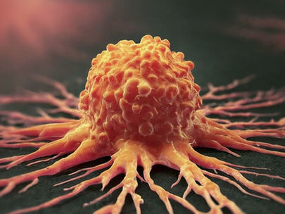 Nisstex and Cancer