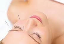 Acupuntura Facial