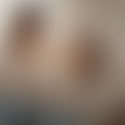 ¿Qué Tan Comunes Son Los Piojos?