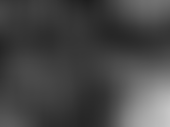 ROBERT UADLOU (WADLOW) | HISTORIA E NJERIUT MË TË GJATË NË BOTË; DIETA E TIJ ISHTE 5000 KALORI NË DITË; LINDI SI FOSHNJË NORMALE; NJË MOSFUNKSIONIM NË TRUPIN E TIJ E SHNDËRROI NË GJIGAND 2.72 CM.